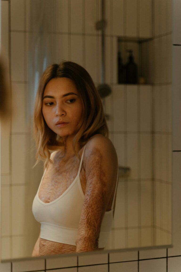 A woman with burn scars gazes at her reflection in a bathroom mirror, conveying strength and resilience.